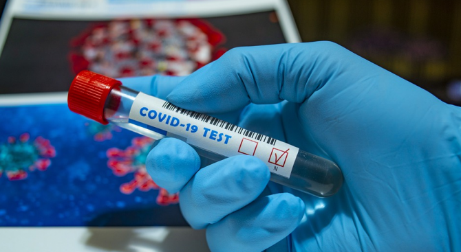 393 са новите случаи на коронавирус у нас